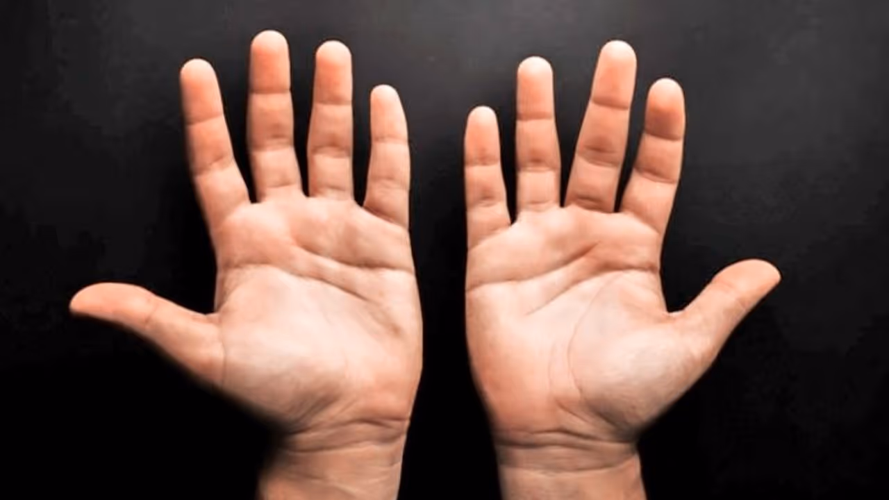 এই বিশেষ রেখাটি হাজারের মধ্যে একজন মানুষের হাতে থাকে, যা নিয়ে আসে প্রচুর সম্পদ