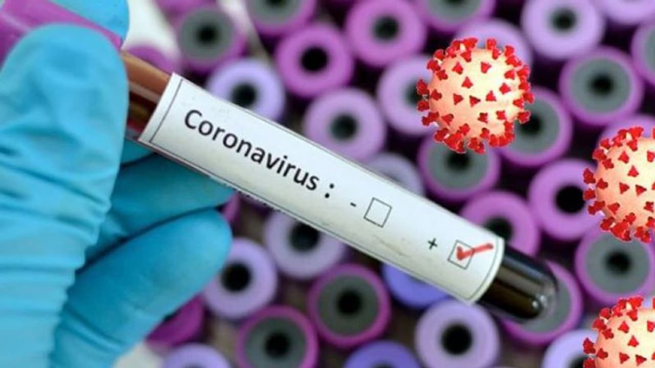 മാർച്ച് ഒന്നിന് നെടുമ്പാശ്ശേരി വിമാനത്താവളത്തിലുണ്ടായിരുന്നവർ കൊവിഡ് 19 പരിശോധനയ്ക്ക് ഹാജരാകണം മാർച്ച് ഒന്നിന് നെടുമ്പാശ്ശേരി വിമാനത്താവളത്തിലുണ്ടായിരുന്നവർ കൊവിഡ് 19 പരിശോധനയ്ക്ക് ഹാജരാകണം