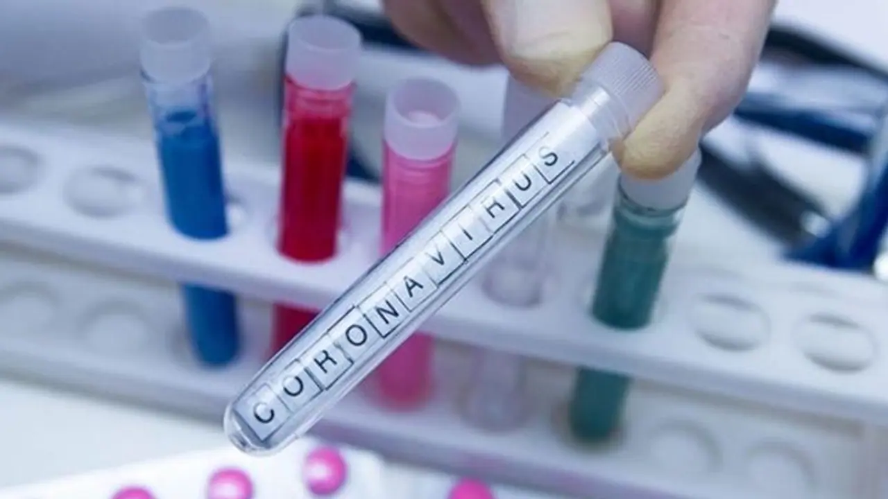 கொரோனா பாதிப்பில் முச்சதமடித்த மகாராஷ்டிரா.. 3ம் இடத்தில் தமிழ்நாடு.. மாநில வாரியாக முழு விவரம் கொரோனா பாதிப்பில் முச்சதமடித்த மகாராஷ்டிரா.. 3ம் இடத்தில் தமிழ்நாடு.. மாநில வாரியாக முழு விவரம்