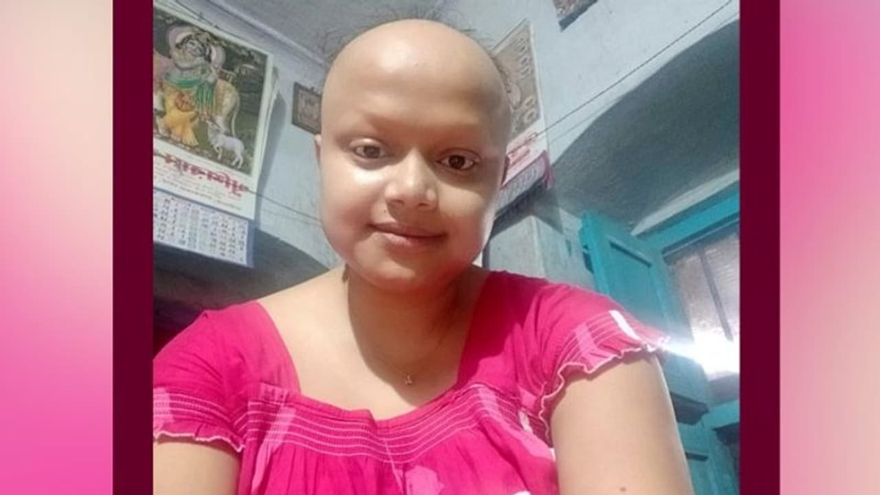 মাথায় চুল নেই, চোখের পাতা নেই, কে হবে সেই মেয়ের জীবনসঙ্গী, প্রশ্ন নেটিজেনদের বিবেককে মাথায় চুল নেই, চোখের পাতা নেই, কে হবে সেই মেয়ের জীবনসঙ্গী, প্রশ্ন নেটিজেনদের বিবেককে