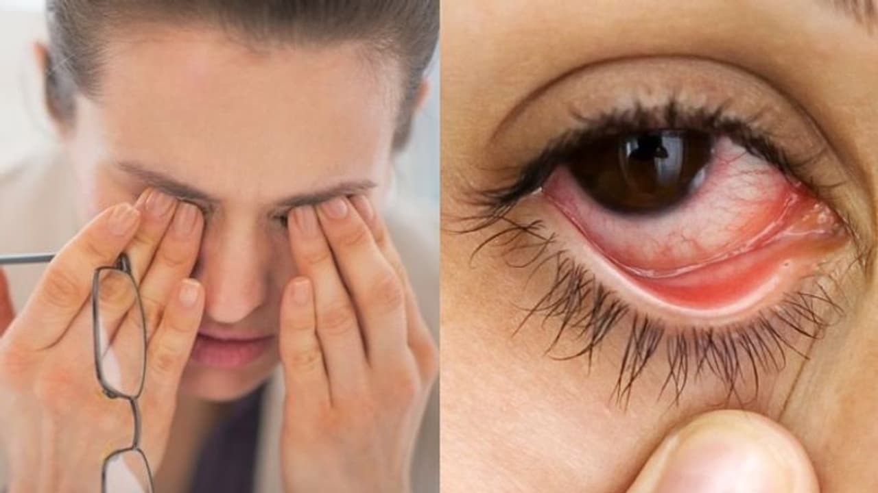 എന്താണ് പിങ്ക് ഐ രോഗം ? ലക്ഷണങ്ങളറിയാം എന്താണ് പിങ്ക് ഐ രോഗം ? ലക്ഷണങ്ങളറിയാം