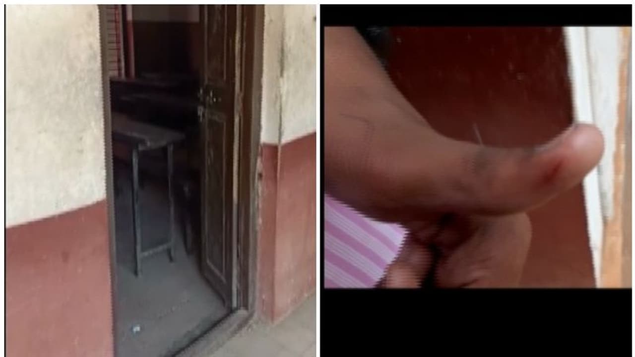 എസ്എസ്എല്സി പരീക്ഷ നടക്കുന്നതിനിടെ വിദ്യാർത്ഥിക്ക് തെരുവുനായയുടെ കടിയേറ്റു എസ്എസ്എല്സി പരീക്ഷ നടക്കുന്നതിനിടെ വിദ്യാർത്ഥിക്ക് തെരുവുനായയുടെ കടിയേറ്റു