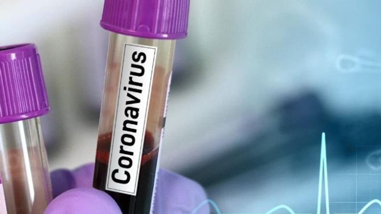 കൊവിഡ് 19: അമേരിക്കന് ദമ്പതികളും കുഞ്ഞും കണ്ണൂരില് നിരീക്ഷണത്തില് കൊവിഡ് 19: അമേരിക്കന് ദമ്പതികളും കുഞ്ഞും കണ്ണൂരില് നിരീക്ഷണത്തില്