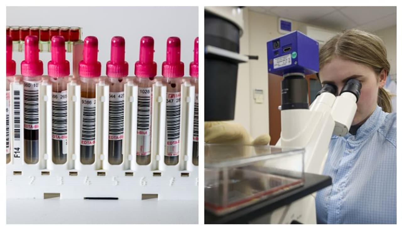 কোন ব্লাড গ্রুপে করোনা সংক্রমণের সম্ভাবনা সবচেয়ে বেশি, গবেষণায় উঠে এল চাঞ্চল্যকর তথ্য