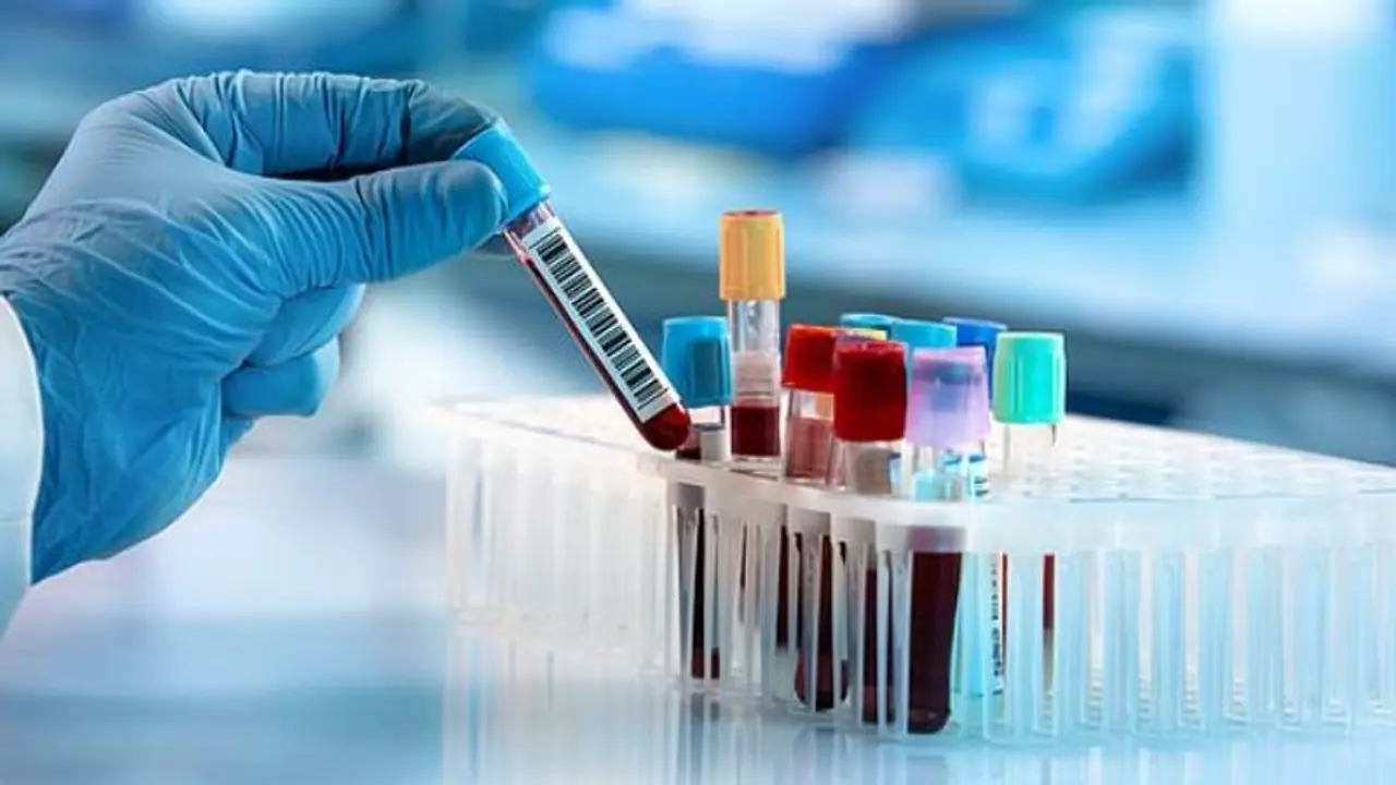 ಮಡಿಕೇರಿ: 10 ಕೊರೋನಾ ಟೆಸ್ಟ್ ಫಲಿತಾಂಶ ನೆಗೆಟಿವ್ ಮಡಿಕೇರಿ: 10 ಕೊರೋನಾ ಟೆಸ್ಟ್ ಫಲಿತಾಂಶ ನೆಗೆಟಿವ್