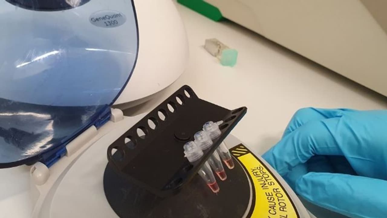 കൊവിഡ് 19: അരമണിക്കൂറിനുള്ളിൽ രോഗനിർണയം നടത്താം; പുതിയ പരിശോധനയുമായി ഗവേഷകർ