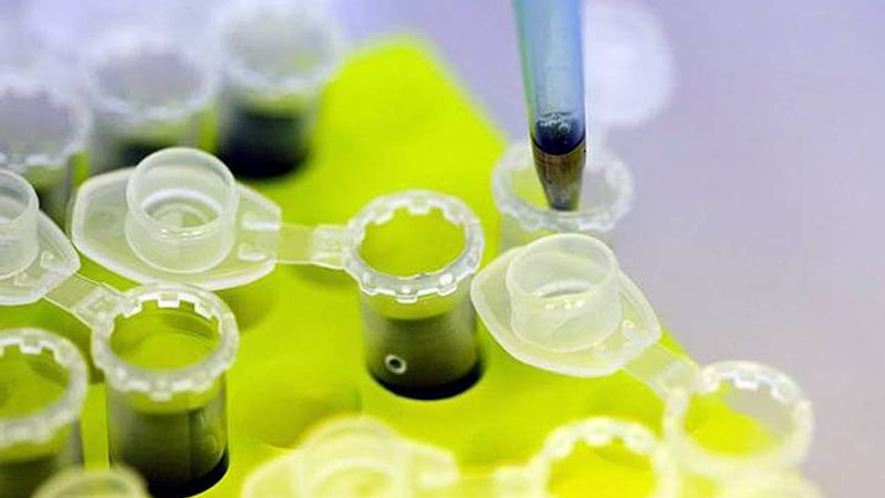 பல நாட்கள் காத்திருக்க வேண்டாம்! 45 நிமிடத்தில் கொரோனா உள்ளதா என உறுதி செய்து விடலாம்! வருகிறது புதிய கருவி! பல நாட்கள் காத்திருக்க வேண்டாம்! 45 நிமிடத்தில் கொரோனா உள்ளதா என உறுதி செய்து விடலாம்! வருகிறது புதிய கருவி!