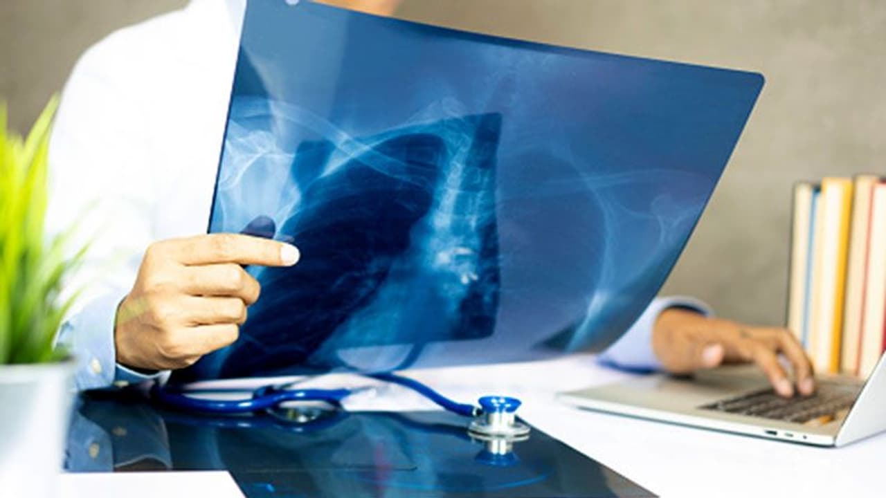 ಕ್ಷಯರೋಗಿಗಳ ಮಾಹಿತಿ ನೀಡಿದವರಿಗೆ 500 ಪೋತ್ಸಾಹ ಧನ