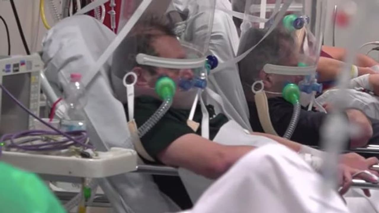 കൊവിഡ് 19; ഇറ്റലിയിലെ ഈ കാഴ്ച്ചകൾ വേദനിപ്പിക്കുന്നത്, ഹെല്മെറ്റ് വെന്റിലേറ്ററിന്റെ ദൃശ്യങ്ങള് പുറത്ത് കൊവിഡ് 19; ഇറ്റലിയിലെ ഈ കാഴ്ച്ചകൾ വേദനിപ്പിക്കുന്നത്, ഹെല്മെറ്റ് വെന്റിലേറ്ററിന്റെ ദൃശ്യങ്ങള് പുറത്ത്