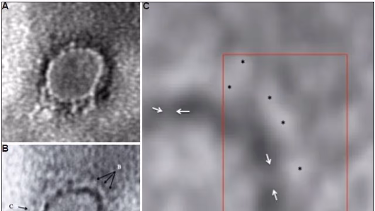 கொரோனா வைரஸ் எப்படி இருக்கும்...அதை நீங்க பார்க்கனுமா...இதோ செய்திக்குள்ளே..!!