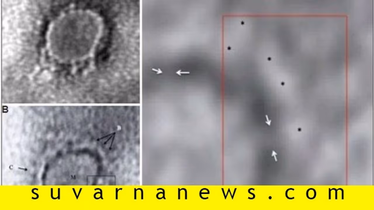 ಭಾರತದ ಮೊತ್ತ ಮೊದಲ ಸೋಂಕಿತನ ಕೊರೋನಾ ವೈರಸ್ ಚಿತ್ರ ಬಿಡುಗಡೆ! ಭಾರತದ ಮೊತ್ತ ಮೊದಲ ಸೋಂಕಿತನ ಕೊರೋನಾ ವೈರಸ್ ಚಿತ್ರ ಬಿಡುಗಡೆ!