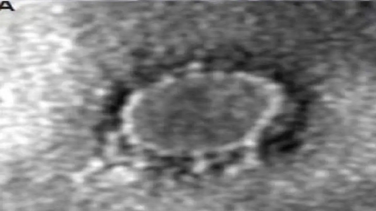 జమ్మలమడుగులో కరోనా పాజిటివ్ వ్యక్తి: ఏపీలో 14కు పెరిగిన సంఖ్య