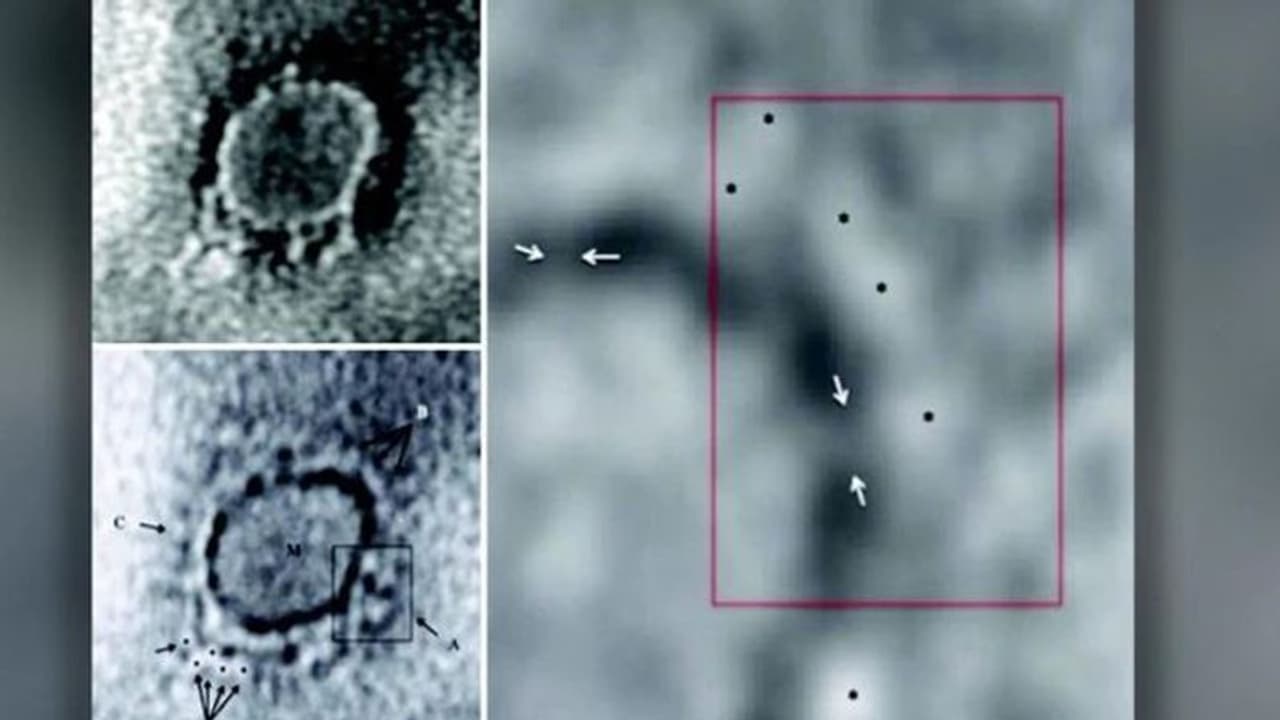 കൊറോണ വൈറസിന്റെ ആദ്യ മൈക്രോസ്കോപ് ചിത്രം പുറത്തുവിട്ട് ഇന്ത്യൻ ശാസ്ത്രജ്ഞർ കൊറോണ വൈറസിന്റെ ആദ്യ മൈക്രോസ്കോപ് ചിത്രം പുറത്തുവിട്ട് ഇന്ത്യൻ ശാസ്ത്രജ്ഞർ