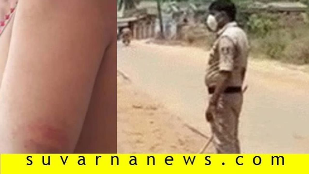 ಲಾಕ್ಡೌನ್: ಸುಬ್ರಮಣ್ಯ ದೇವಳದ ಅರ್ಚಕರ ಮೇಲೆ ಹಲ್ಲೆ..! ಲಾಕ್ಡೌನ್: ಸುಬ್ರಮಣ್ಯ ದೇವಳದ ಅರ್ಚಕರ ಮೇಲೆ ಹಲ್ಲೆ..!