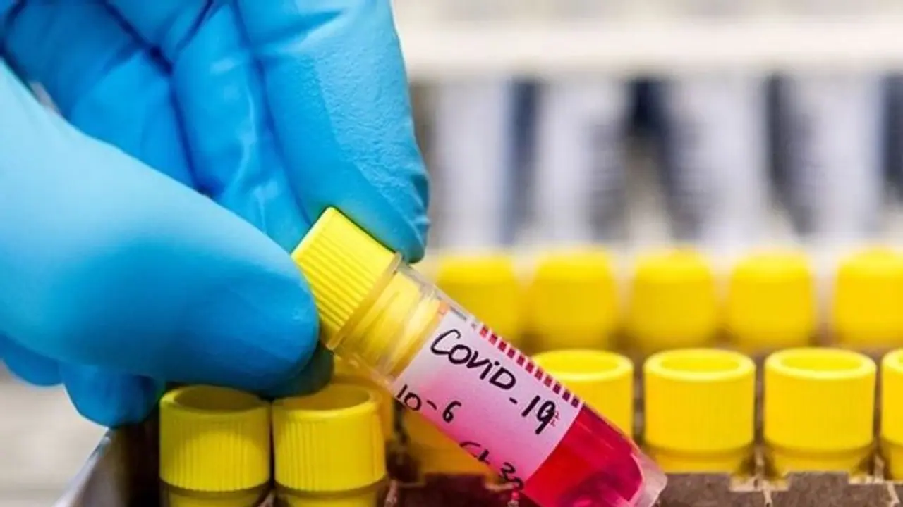 Tamil Nadu notifies 21 government hospitals exclusively for COVID 19 treatment Tamil Nadu notifies 21 government hospitals exclusively for COVID 19 treatment