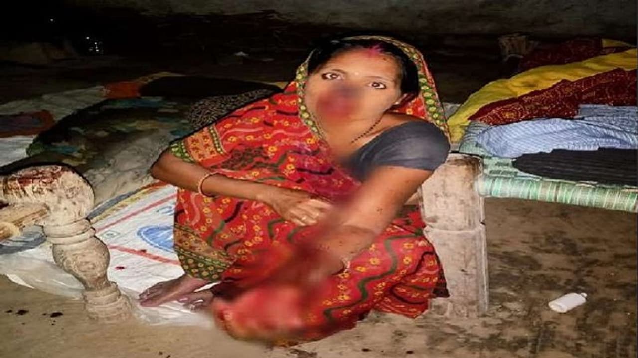 एक छोटी सी बात के लिए दर्दनाक सजा, पति ने पत्नी की काट दी नाक एक छोटी सी बात के लिए दर्दनाक सजा, पति ने पत्नी की काट दी नाक