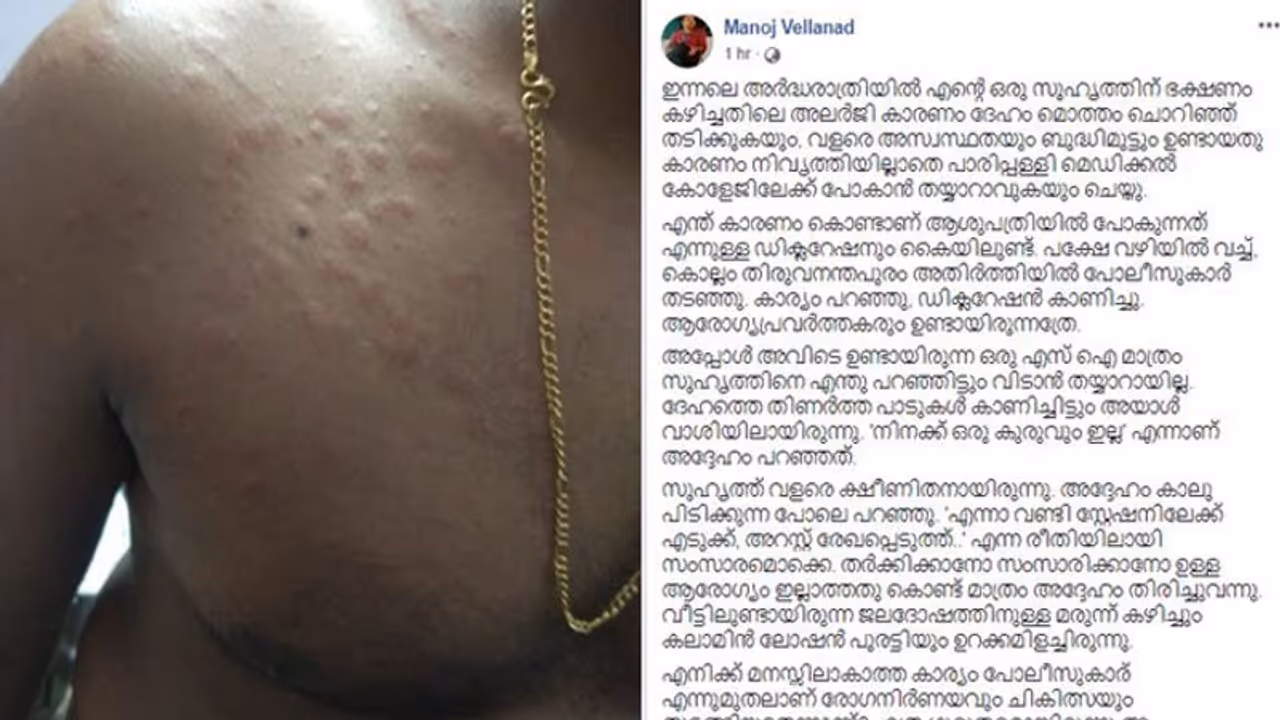 ദേഹം മൊത്തം ചൊറിഞ്ഞ് തടിച്ചു, അസ്വസ്ഥതകൾ ഉണ്ടായി; പൊലീസുകാര് രോഗിയെ തടഞ്ഞു, ഡോക്ടറുടെ കുറിപ്പ് ദേഹം മൊത്തം ചൊറിഞ്ഞ് തടിച്ചു, അസ്വസ്ഥതകൾ ഉണ്ടായി; പൊലീസുകാര് രോഗിയെ തടഞ്ഞു, ഡോക്ടറുടെ കുറിപ്പ്