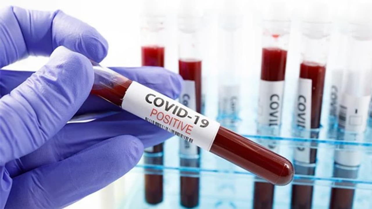 വീടുകള്‍ കയറിയിറങ്ങി കൊവിഡ് വ്യാജ പരിശോധന; സൗദിയില്‍ വിദേശികള്‍ പിടിയില്‍