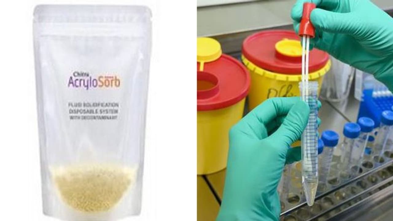 അണുബാധയുള്ള ശ്വസന സ്രവങ്ങള്‍ സുരക്ഷിതമായി കൈകാര്യം ചെയ്യാന്‍ സൂപ്പര്‍ അബ്‌സോര്‍ബന്റുമായി ശ്രീചിത്ര