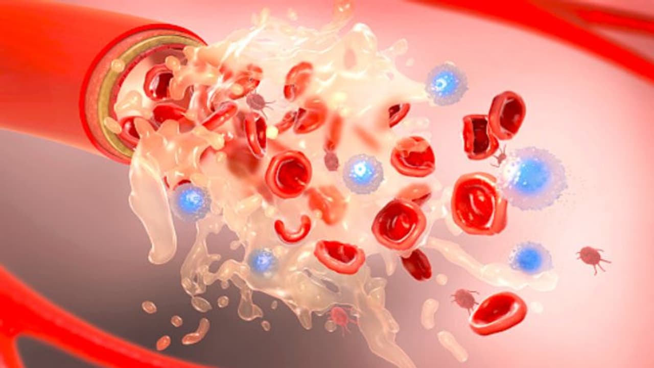 ಅಮೆರಿಕದಲ್ಲಿ ಭಾರತೀಯರ ಮೇಲೆ ಪ್ಲಾಸ್ಮಾ ಥೆರಪಿ ಯಶಸ್ವಿ!