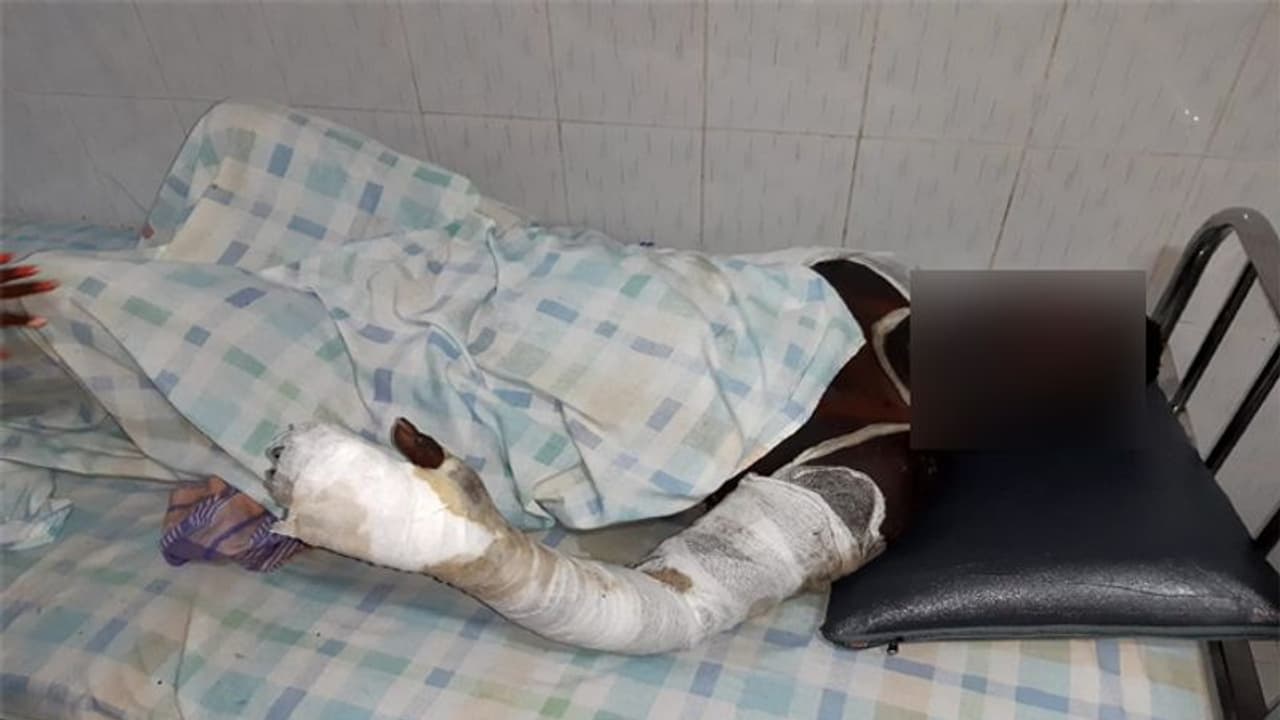 వివాహేతర సంబంధం... ప్రియుడిపై పెట్రోల్ పోసి నిప్పంటించిన ప్రియురాలు వివాహేతర సంబంధం... ప్రియుడిపై పెట్రోల్ పోసి నిప్పంటించిన ప్రియురాలు