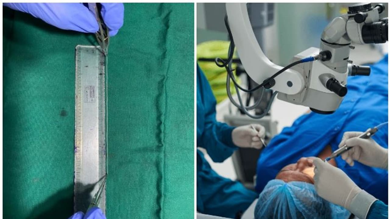 അസഹ്യവേദന; കായംകുളത്ത് വീട്ടമ്മയുടെ കണ്ണില് നിന്ന് ജീവനോടെ വിരയെ പുറത്തെടുത്തു അസഹ്യവേദന; കായംകുളത്ത് വീട്ടമ്മയുടെ കണ്ണില് നിന്ന് ജീവനോടെ വിരയെ പുറത്തെടുത്തു