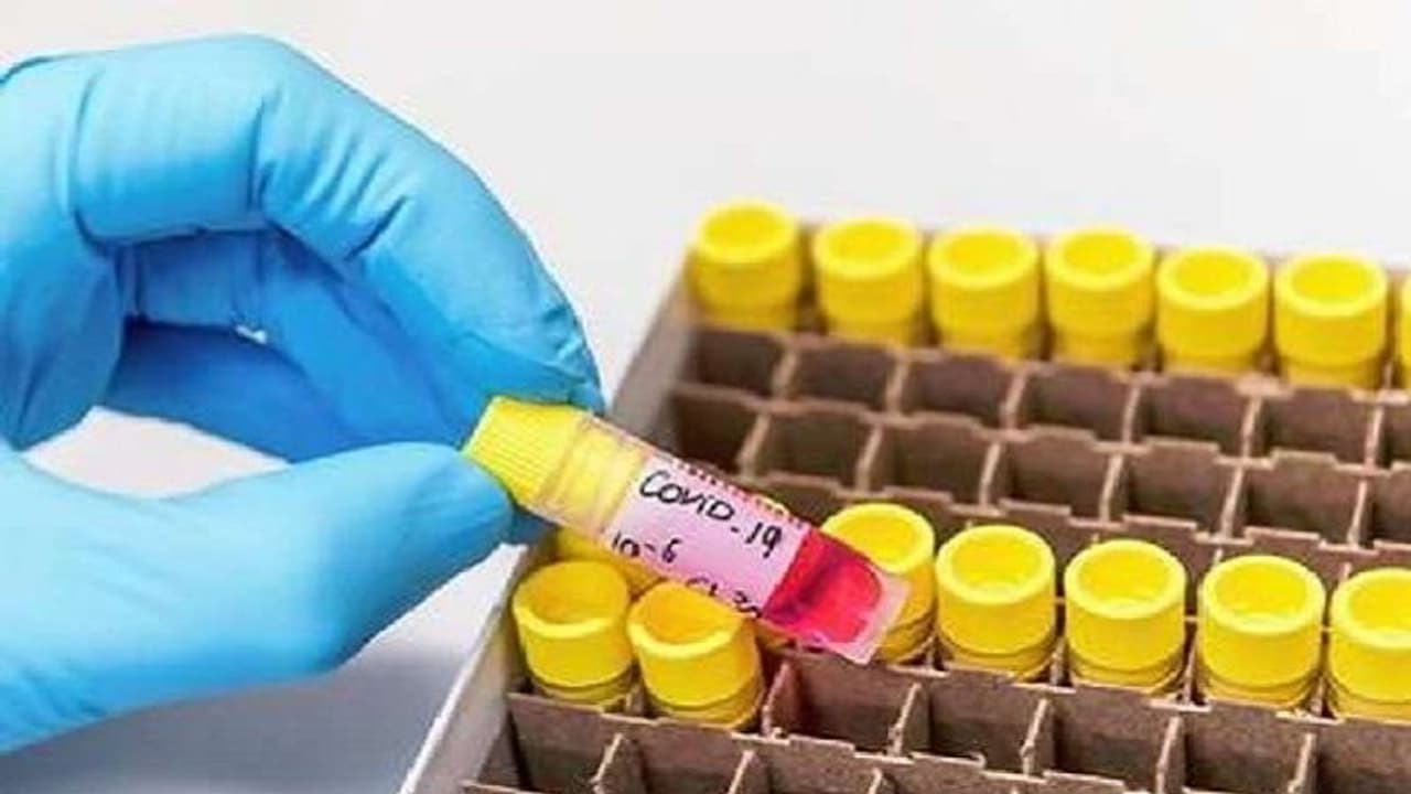 ఇల్లు దాటకున్నా హైద్రాబాద్‌లో ఇద్దరికి కరోనా