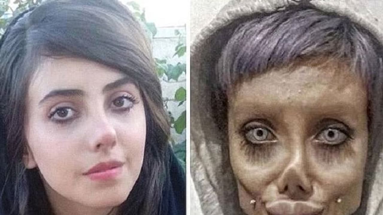 ನಟಿಯಂತೆ ಕಾಣಲು ಸರ್ಜರಿ, ಕೊರೋನಾ ವಕ್ಕರಿಸಿ ಜೀವನ್ಮರಣ ಹೋರಾಟದಲ್ಲಿ ಸುಂದರಿ! ನಟಿಯಂತೆ ಕಾಣಲು ಸರ್ಜರಿ, ಕೊರೋನಾ ವಕ್ಕರಿಸಿ ಜೀವನ್ಮರಣ ಹೋರಾಟದಲ್ಲಿ ಸುಂದರಿ!