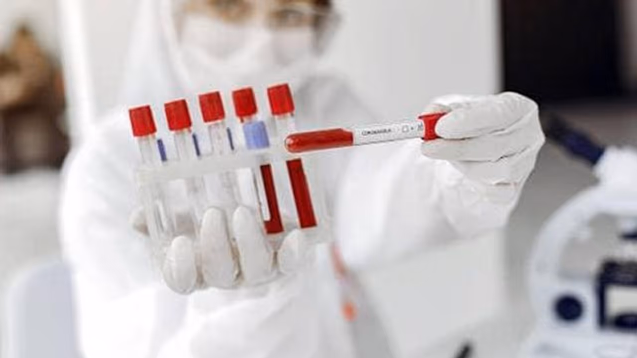 രാജ്യത്ത് കൊവിഡ് ഭീതിയൊഴിയുന്നില്ല; രോഗികളുടെ എണ്ണത്തില് വര്ധനവ്, മഹാരാഷ്ട്രയില് 4200 ലേറെ കൊവിഡ് ബാധിതര് രാജ്യത്ത് കൊവിഡ് ഭീതിയൊഴിയുന്നില്ല; രോഗികളുടെ എണ്ണത്തില് വര്ധനവ്, മഹാരാഷ്ട്രയില് 4200 ലേറെ കൊവിഡ് ബാധിതര്