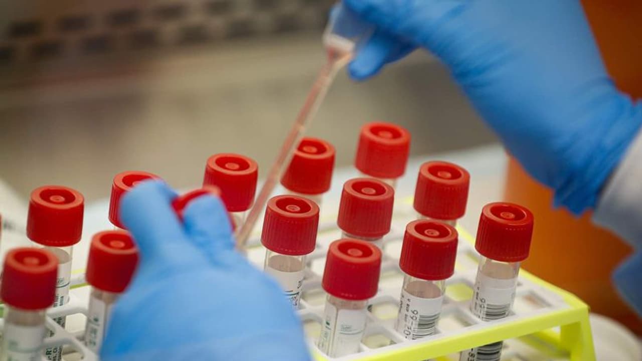 മഹാരാഷ്ട്രയിൽ 12 കൊവിഡ് മരണം കൂടി; ആറും മുംബൈയില്, 24 മണിക്കൂറിനിടെ 552 പേർക്ക് രോഗം മഹാരാഷ്ട്രയിൽ 12 കൊവിഡ് മരണം കൂടി; ആറും മുംബൈയില്, 24 മണിക്കൂറിനിടെ 552 പേർക്ക് രോഗം