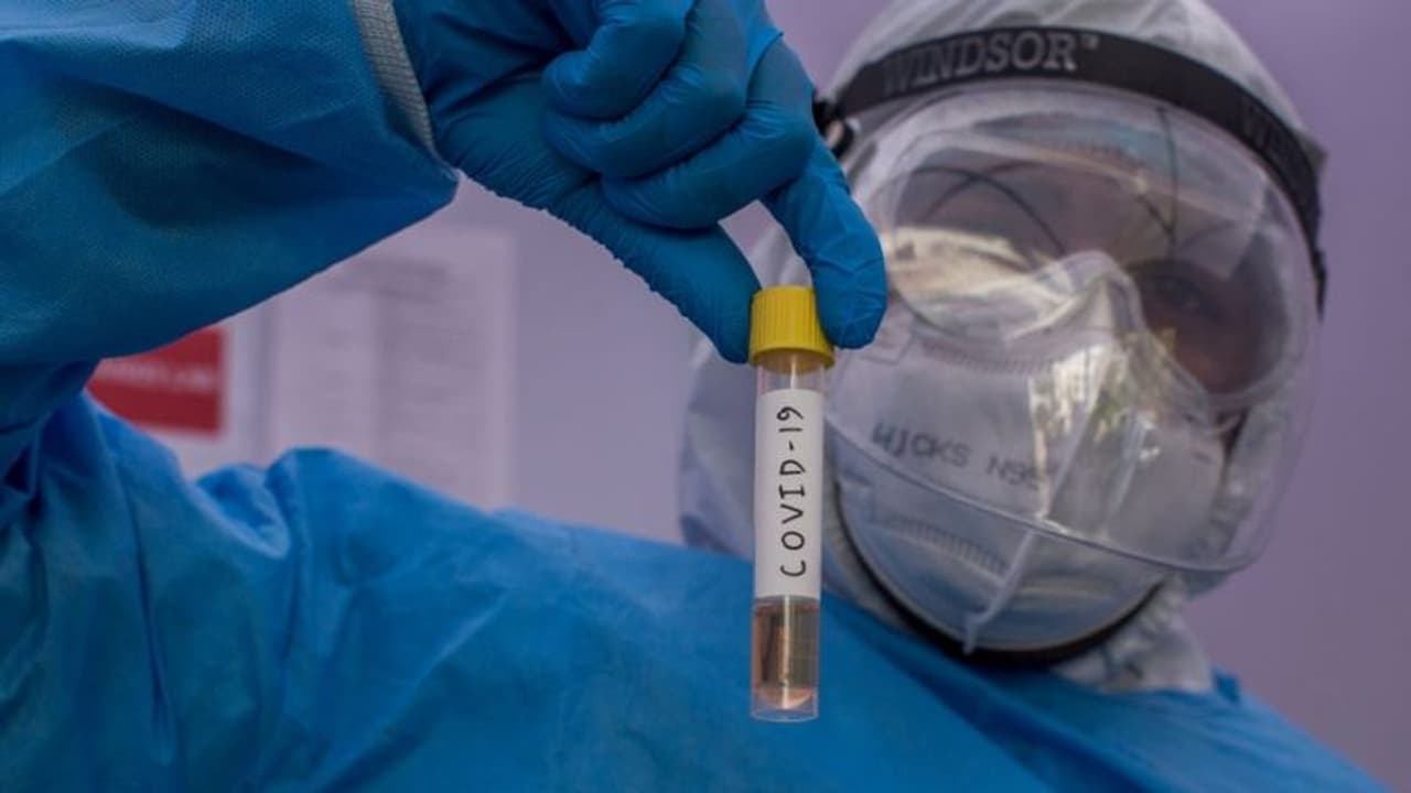 കൊവിഡ്; പ്ലാസ്മ തെറാപ്പി പരീക്ഷിക്കാൻ 99 സ്ഥാപനങ്ങള് തയ്യാറായിട്ടുണ്ടെന്ന് ഐസിഎംആര് കൊവിഡ്; പ്ലാസ്മ തെറാപ്പി പരീക്ഷിക്കാൻ 99 സ്ഥാപനങ്ങള് തയ്യാറായിട്ടുണ്ടെന്ന് ഐസിഎംആര്