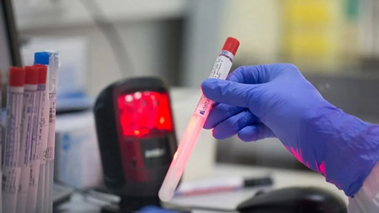 தமிழகத்தில் வேகம் எடுக்கும் கொரோனா... உயிரிழந்தவர் எண்ணிக்கை 17ஆக உயர்வு..! தமிழகத்தில் வேகம் எடுக்கும் கொரோனா... உயிரிழந்தவர் எண்ணிக்கை 17ஆக உயர்வு..!