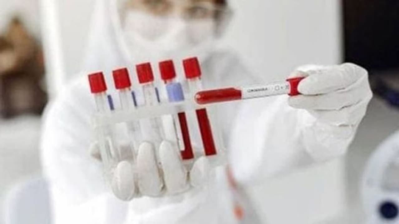 কোন পথে রোখা যাবে করোনার বৃদ্ধি, অঙ্ক কষে ব্যাখ্যা দিলেন বাঙালি বিজ্ঞানী কোন পথে রোখা যাবে করোনার বৃদ্ধি, অঙ্ক কষে ব্যাখ্যা দিলেন বাঙালি বিজ্ঞানী