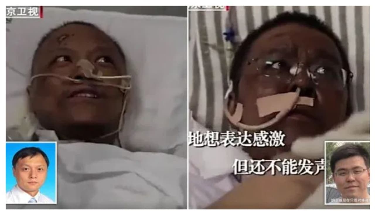 করোনার এবার পার্শ্বপ্রতিক্রিয়া শুরু চিনে, ফরসা থেকে কালো হয়ে গেলেন ২ চিকিৎসক করোনার এবার পার্শ্বপ্রতিক্রিয়া শুরু চিনে, ফরসা থেকে কালো হয়ে গেলেন ২ চিকিৎসক