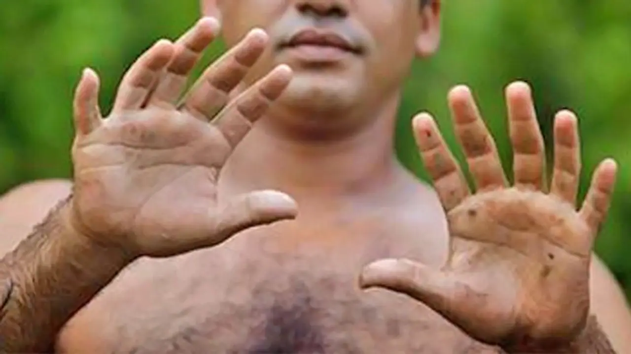 जिन लोगों के हाथों में होती हैं 10 से ज्यादा उंगलियां, वो होते हैं किस्मत वाले जिन लोगों के हाथों में होती हैं 10 से ज्यादा उंगलियां, वो होते हैं किस्मत वाले