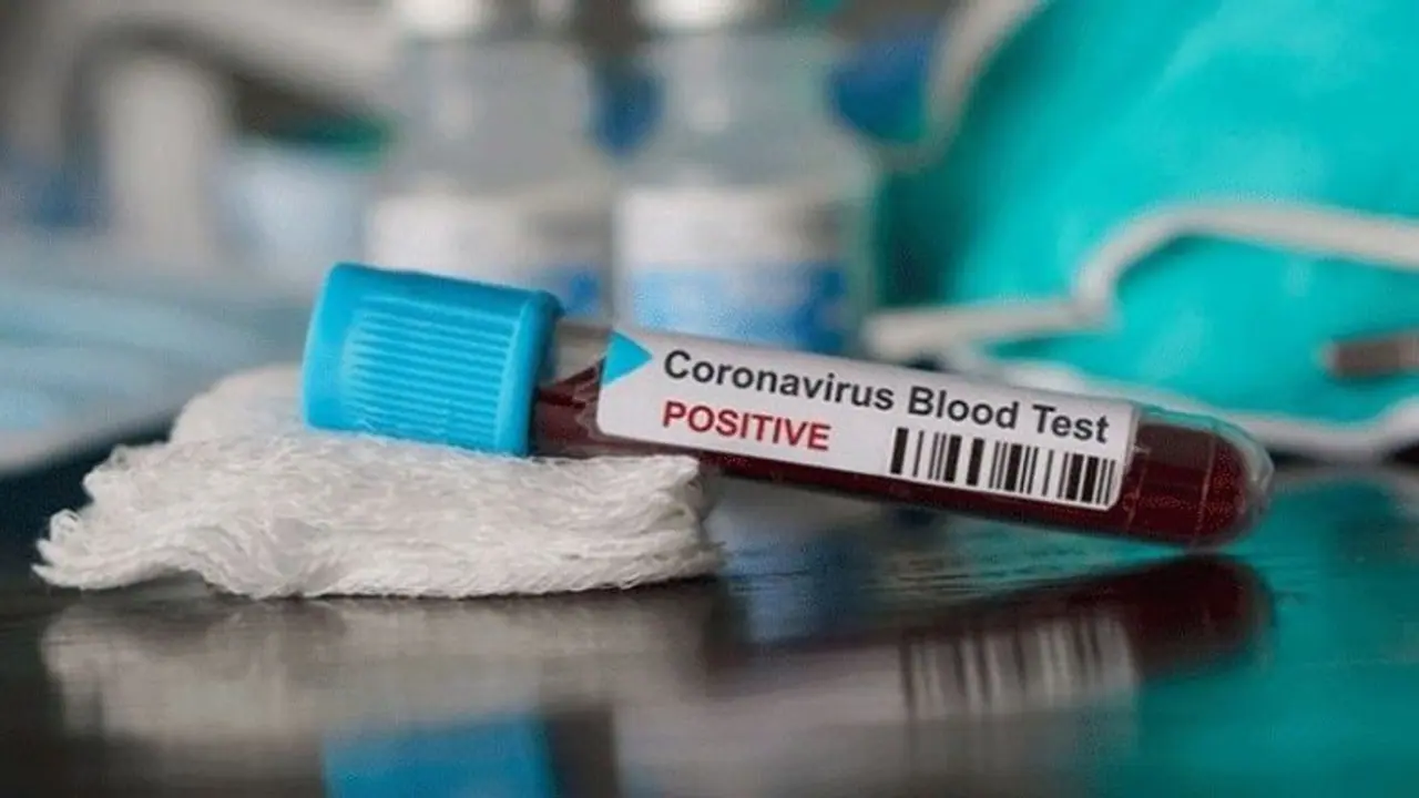 தலைநகரை தலைகீழாக போட்ட கொரோனா... கோயம்பேடு சந்தையில் மேலும் 4 பேருக்கு பாதிப்பு உறுதி..! தலைநகரை தலைகீழாக போட்ட கொரோனா... கோயம்பேடு சந்தையில் மேலும் 4 பேருக்கு பாதிப்பு உறுதி..!