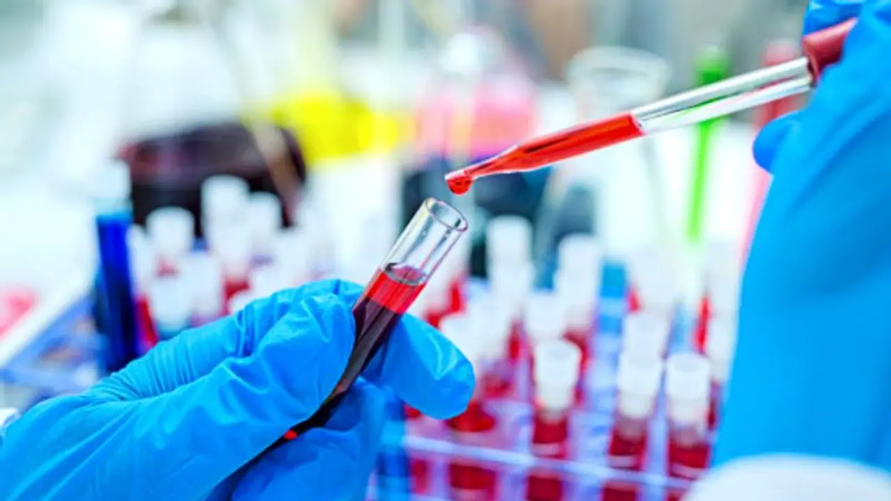 മഹാരാഷ്ട്രയിൽ ആദ്യമായി പ്ലാസ്മാ തെറാപ്പി നടത്തിയ കൊവിഡ് രോഗി മരിച്ചു മഹാരാഷ്ട്രയിൽ ആദ്യമായി പ്ലാസ്മാ തെറാപ്പി നടത്തിയ കൊവിഡ് രോഗി മരിച്ചു