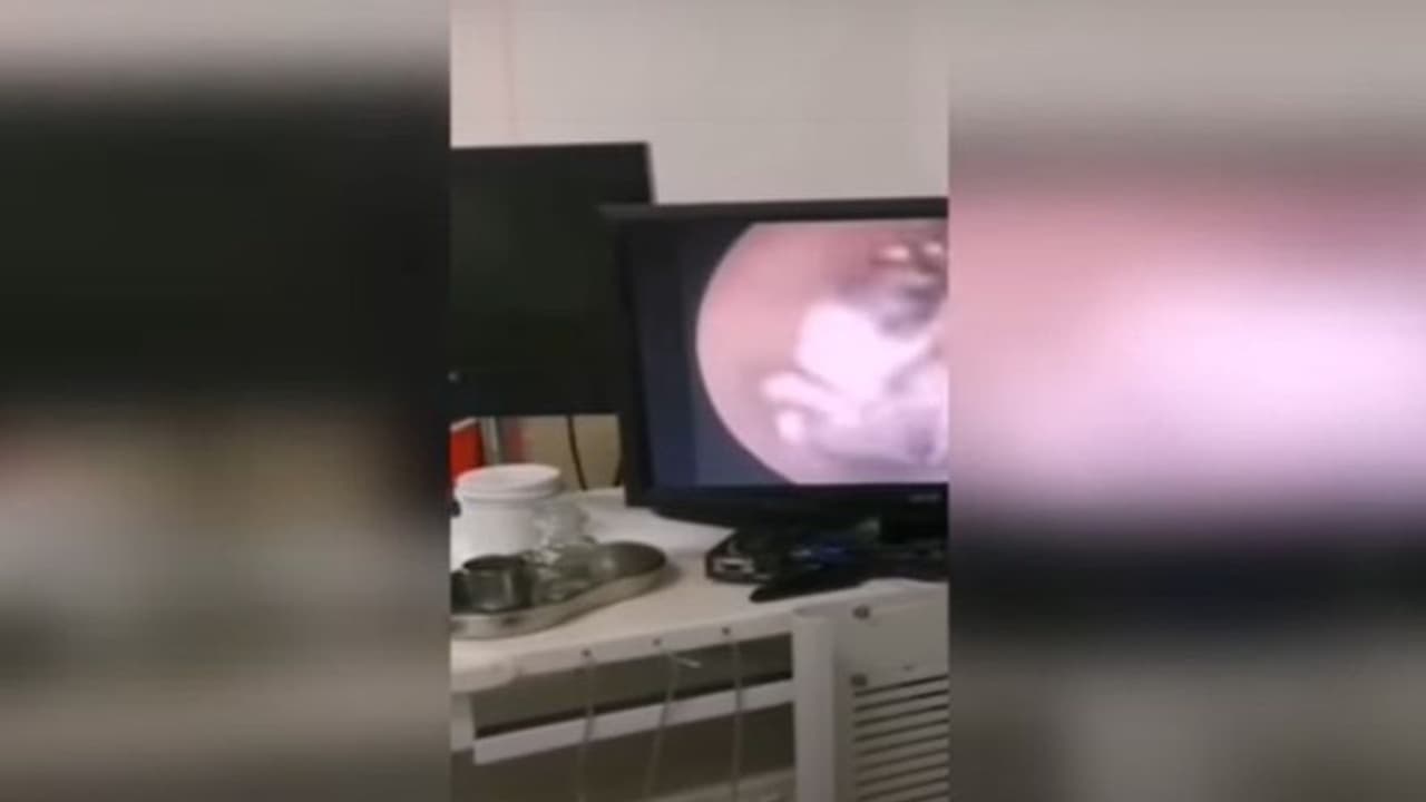 സ്ത്രീയുടെ ചെവിക്കുള്ളില് വല കെട്ടി, താമസമാക്കി എട്ടുകാലി; തരിച്ചുപോകും ഈ വീഡിയോ കണ്ടാല്... സ്ത്രീയുടെ ചെവിക്കുള്ളില് വല കെട്ടി, താമസമാക്കി എട്ടുകാലി; തരിച്ചുപോകും ഈ വീഡിയോ കണ്ടാല്...