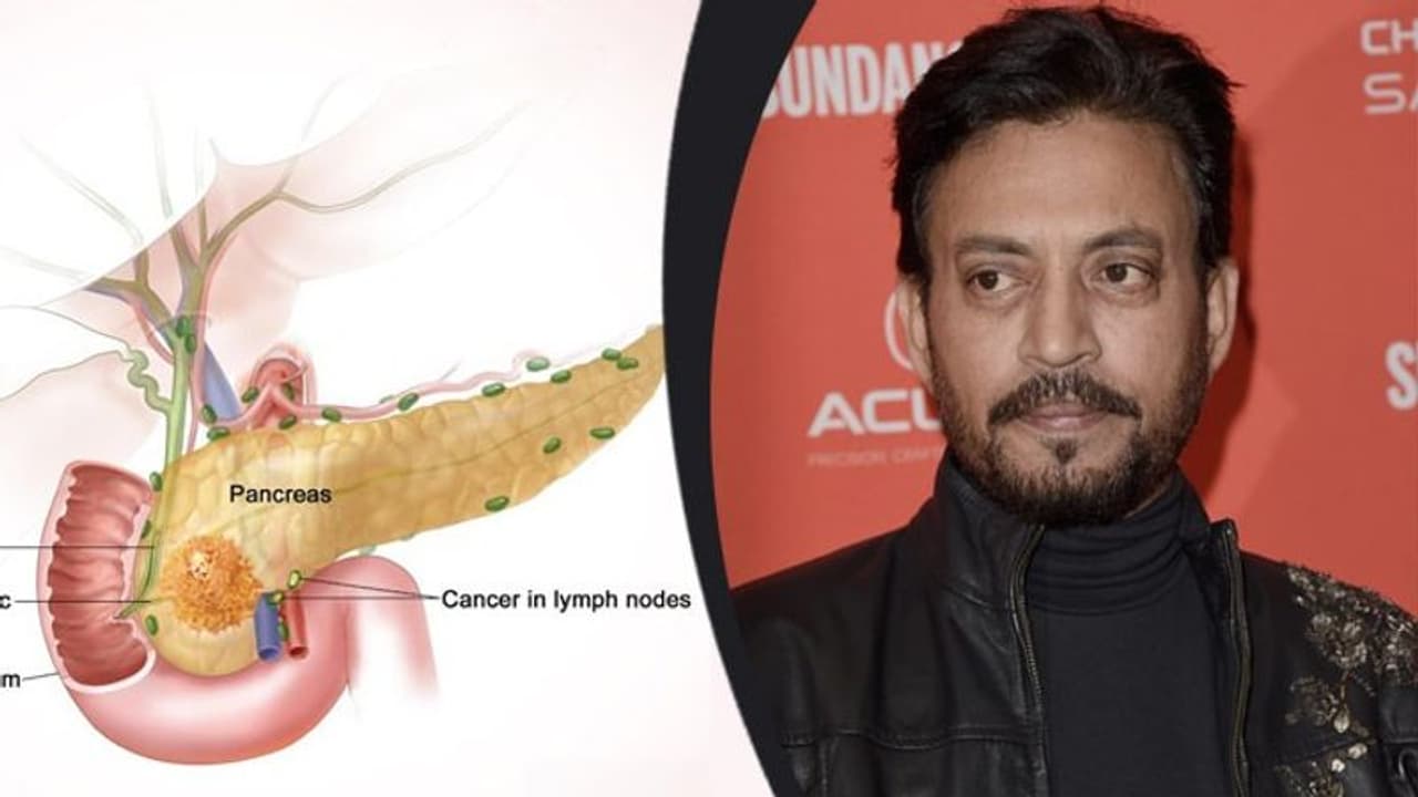 রীতিমতো গানপয়েন্টে তাক হয়ে যাওয়া যাকে বলে, এভাবেই ইরফানের প্রাণ কাড়ল ক্যানসার নেট রীতিমতো গানপয়েন্টে তাক হয়ে যাওয়া যাকে বলে, এভাবেই ইরফানের প্রাণ কাড়ল ক্যানসার নেট