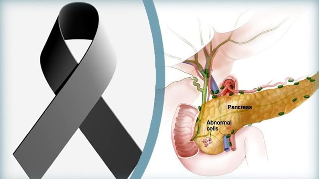 বিরল রোগে আক্রান্ত হয়েছিলেন ইরফান, কতটা আগ্রাসী এই নিউরোএন্ডোক্রাইন টিউমার বা ক্যানসার নেট বিরল রোগে আক্রান্ত হয়েছিলেন ইরফান, কতটা আগ্রাসী এই নিউরোএন্ডোক্রাইন টিউমার বা ক্যানসার নেট