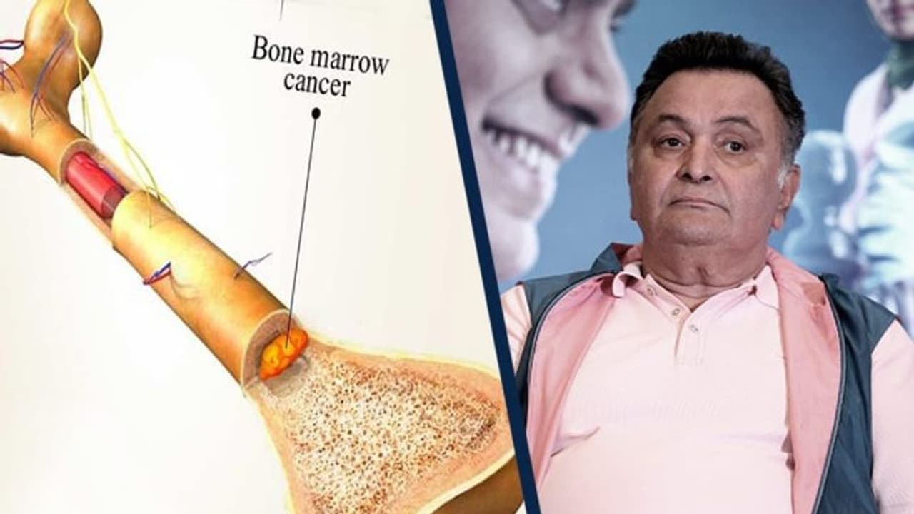 ২ বছর লড়াইয়ের পর হার মানলেন ক্যান্সারের কাছে, চিনে নিন এই ভয়াবহ মারণব্যাধিকে ২ বছর লড়াইয়ের পর হার মানলেন ক্যান্সারের কাছে, চিনে নিন এই ভয়াবহ মারণব্যাধিকে