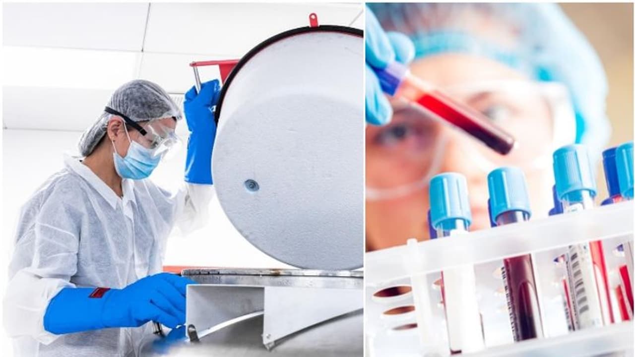 കൊവിഡ് പോരാട്ടത്തില് പുതിയ വഴിത്തിരിവ്; നിര്ണായക ചികിത്സാ രീതി വികസിപ്പിച്ച് യുഎഇ കൊവിഡ് പോരാട്ടത്തില് പുതിയ വഴിത്തിരിവ്; നിര്ണായക ചികിത്സാ രീതി വികസിപ്പിച്ച് യുഎഇ