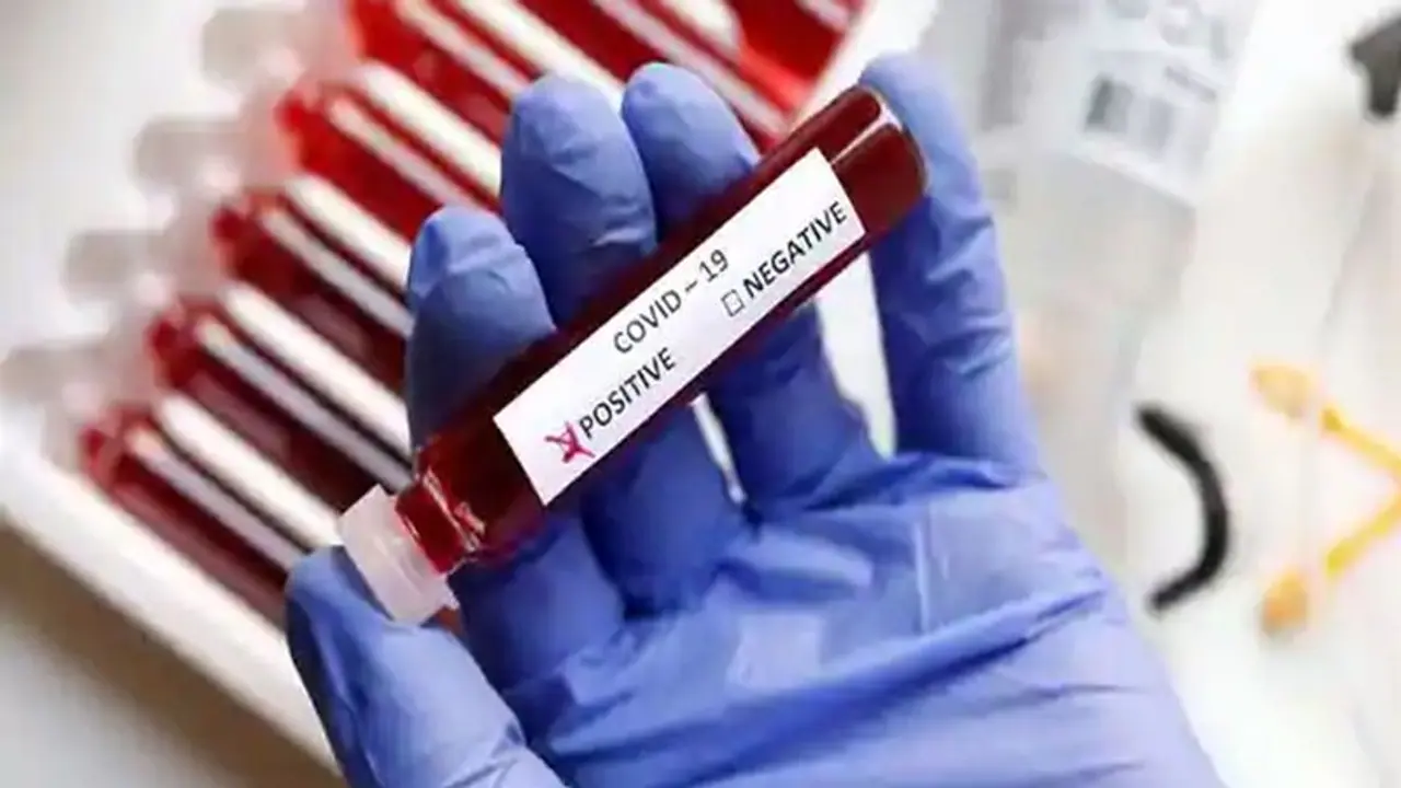 আগামী ২ সপ্তাহের মধ্যে রাজ্যেও শুরু হতে পারে প্লাজমা থেরাপি , তৈরি রয়েছে মেডিক্যাল কলেজ আগামী ২ সপ্তাহের মধ্যে রাজ্যেও শুরু হতে পারে প্লাজমা থেরাপি , তৈরি রয়েছে মেডিক্যাল কলেজ