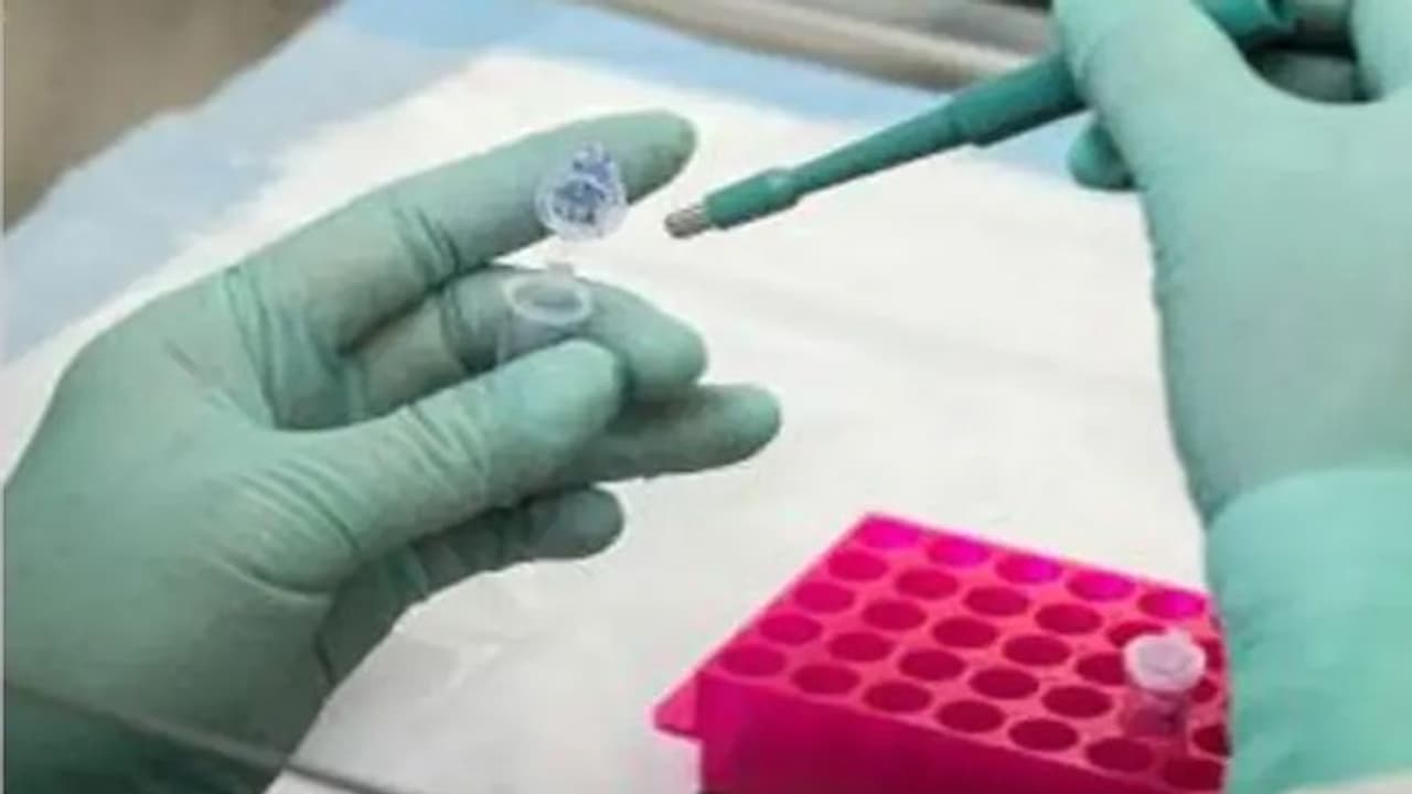 ఏపీలో భారీగా తగ్గిన కేసులు: కలవరపెడుతున్న మరణాలు, ఒక్కరోజే ప.గోలో 20 మంది మృతి ఏపీలో భారీగా తగ్గిన కేసులు: కలవరపెడుతున్న మరణాలు, ఒక్కరోజే ప.గోలో 20 మంది మృతి