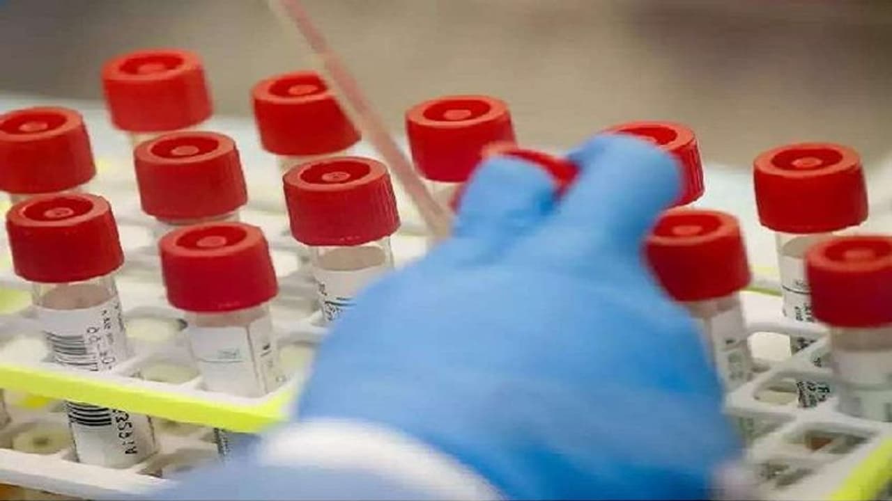 കൊവിഡ് 19: കോഴിക്കോട് ജില്ലയില് 22,395 പേര് നിരീക്ഷണം പൂര്ത്തിയാക്കി കൊവിഡ് 19: കോഴിക്കോട് ജില്ലയില് 22,395 പേര് നിരീക്ഷണം പൂര്ത്തിയാക്കി