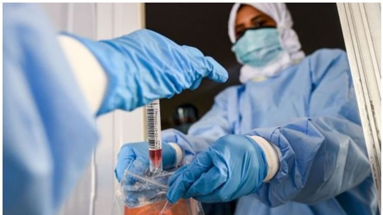 കൊവിഡ് ലക്ഷണങ്ങളുള്ള എല്ലാവര്ക്കും സൗജന്യ പരിശോധന ഏര്പ്പെടുത്തി അബുദാബി കൊവിഡ് ലക്ഷണങ്ങളുള്ള എല്ലാവര്ക്കും സൗജന്യ പരിശോധന ഏര്പ്പെടുത്തി അബുദാബി