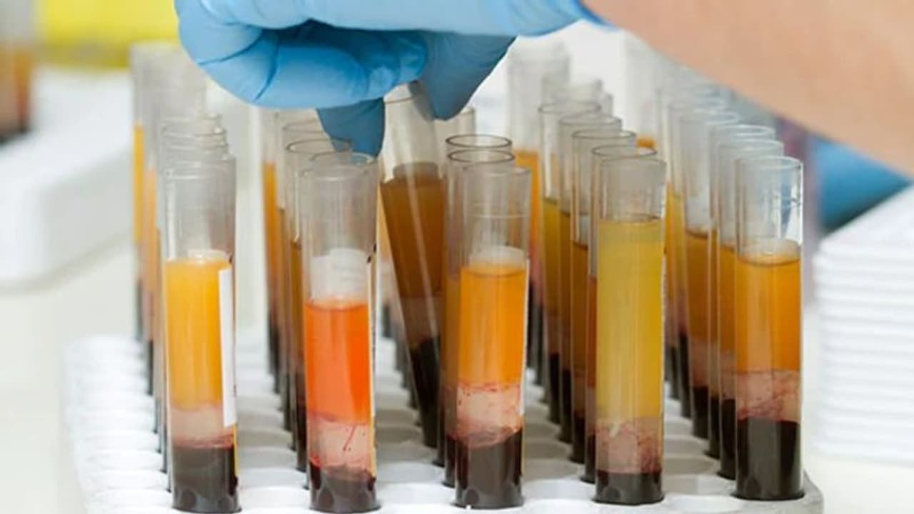 കൊവിഡ് രോഗിയുടെ മരണം; 'പ്ലാസ്മ തെറാപ്പി' അപകടമോ?