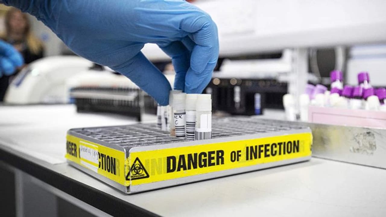 भारत में कोरोना के खिलाफ अलग अलग स्टेज पर 30 वैक्सीन का काम, पेड़ों के अर्क से भी दवा बनाने की संभावना भारत में कोरोना के खिलाफ अलग अलग स्टेज पर 30 वैक्सीन का काम, पेड़ों के अर्क से भी दवा बनाने की संभावना