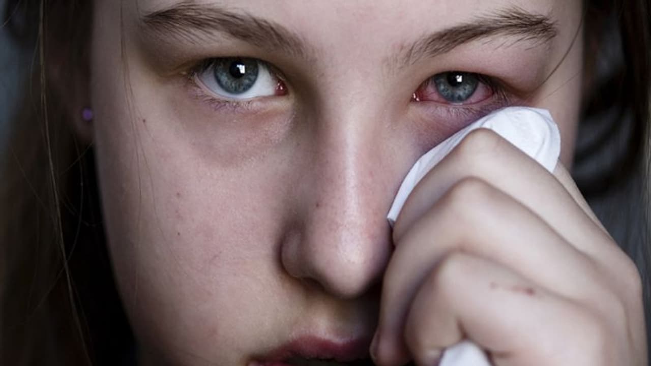 मुंह में निवाला डालते ही आंखों से बहने लगते हैं आंसू, दुनियाभर में सिर्फ 95 लोग इस सिंड्रोम से पीड़ित 