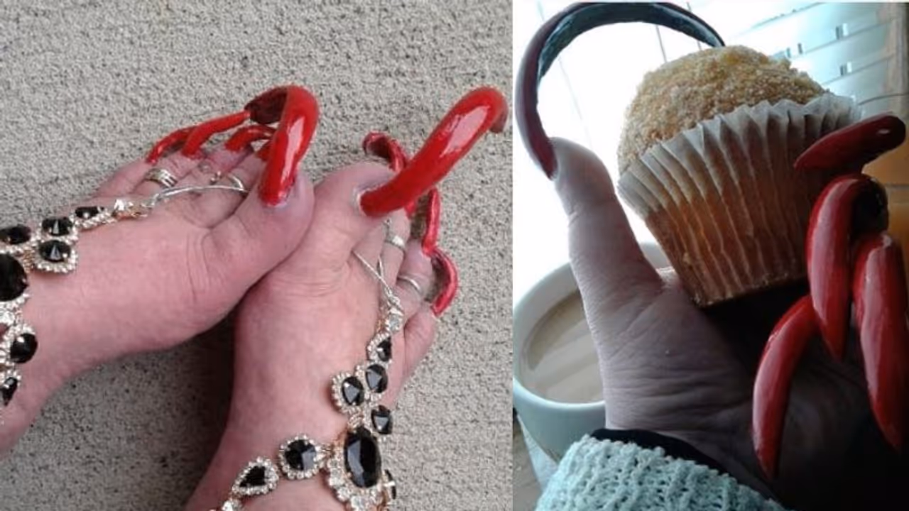 'ഇത് അപൂർവ്വം'; ഇങ്ങനെയും നഖം വളരുമോ? അമ്പരന്ന് സോഷ്യല്‍ മീഡിയ !